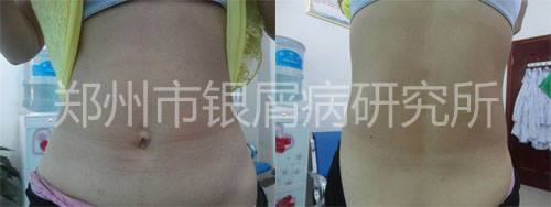 ���޹�ͬ������м�� ��Ϊ������Ӯ��