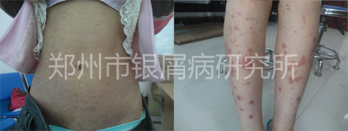 ���޹�ͬ������м�� ��Ϊ������Ӯ��