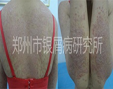 ���޹�ͬ������м�� ��Ϊ������Ӯ��