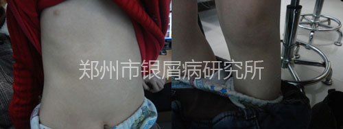 8���ͯսʤ��м�� ӵ������ͯ��