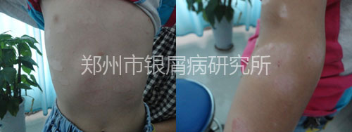 8���ͯսʤ��м�� ӵ������ͯ��