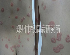 8���ͯսʤ��м�� ӵ������ͯ��