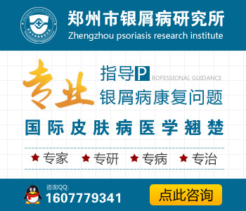新乡治疗牛皮癣最权威的医院