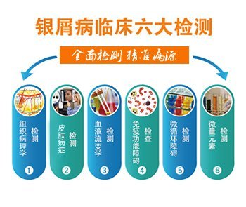 �����������߼����Ʒ�&mdash;&mdash;����Ȩ�����