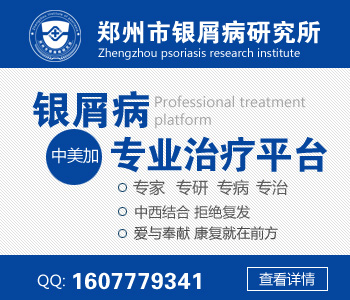 新乡银屑病研究所